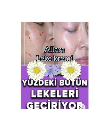 Allara Blemish Care Cream