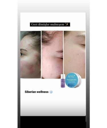 SIBERIAN WELNESS Siberian Wellness Spot Lightening Face Mask Face Mask Peeling - Buy Online on GoSupps.com