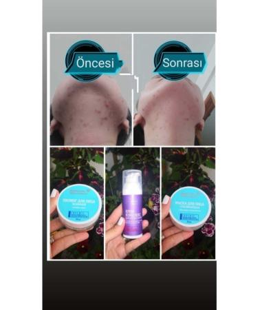 SIBERIAN WELNESS Siberian Wellness Spot Lightening Face Mask Face Mask Peeling - Buy Online on GoSupps.com