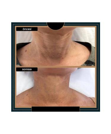 SECRET LIFT Organic Plant Essence Neck Mask for Neck 1 Piece - Buy Online on GoSupps.com