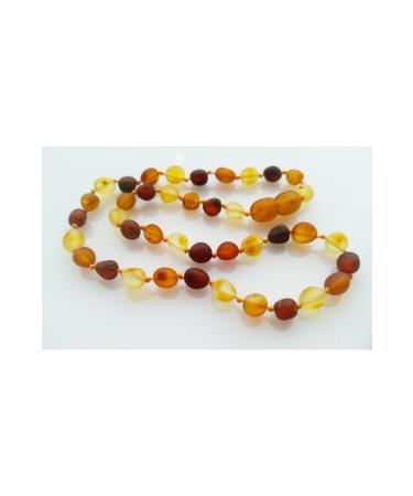 Certified Baroque Grained Amber Tooth Necklace for Your Name Tesbihci Efendi