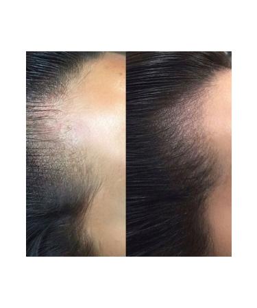 Pavone Scalp Pigment - Hair Simulation Pigment - Hair Simulation Dye - Buy Online on GoSupps.com