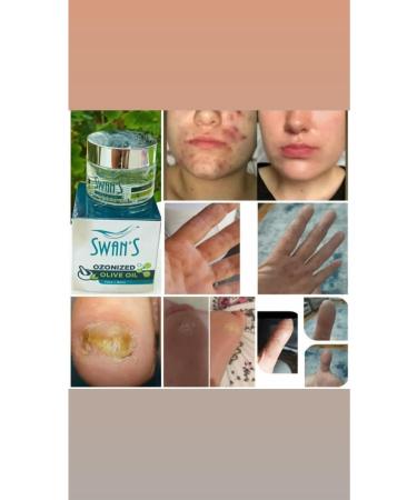 Swans Medical Ozone Oil Transparent Bottle 50 Ml - Buy Online on GoSupps.com