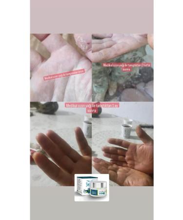 Swans Medical Ozone Oil Transparent Bottle 50 Ml - Buy Online on GoSupps.com