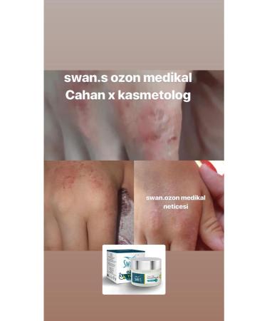 Swans Medical Ozone Oil Transparent Bottle 50 Ml - Buy Online on GoSupps.com