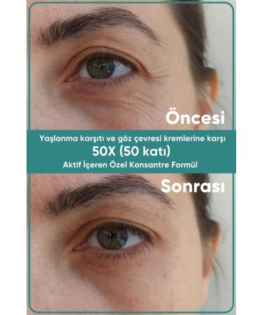 yesilmarka Triple Effect Cream (lifting Anti Aging Brightening) Botox Whitening - Buy Online on GoSupps.com