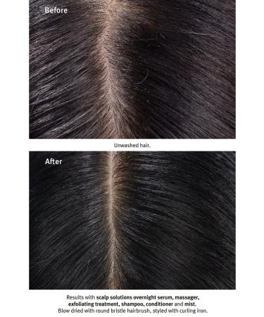 Aveda Scalp Solutions Shampoo For Scalp 200ml 018084040546 - Buy Online on GoSupps.com