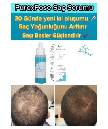 Purexpose Men&Women Hair Care Serum and Hair Growth Aid Serum 1 Piece - Buy Online on GoSupps.com