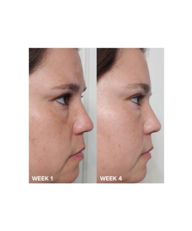 Paulas Choice Skin Perfecting 2% Bha Liquid Exfoliant (30ml) - Buy Online on GoSupps.com