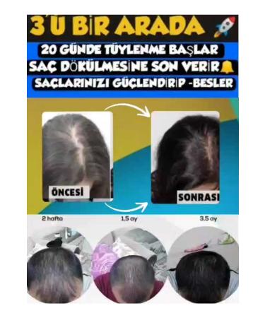 Purexpose Hair Care Serum - Hair Growth Helper Hair Formation Visualizer Extender 4 Pieces Dermaroller - Buy Online on GoSupps.com