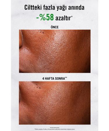 Kiehl's Ultra Pure 5% Niacinamide Face Serum to Reduce Shine and Oiliness 30ml - Buy Online on GoSupps.com