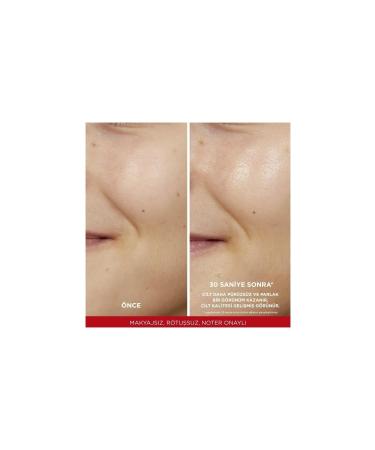 L'Oreal Paris L'or al Paris Revitalift %5 Pure Glycolic Acid Peeling Toner - Buy Online on GoSupps.com