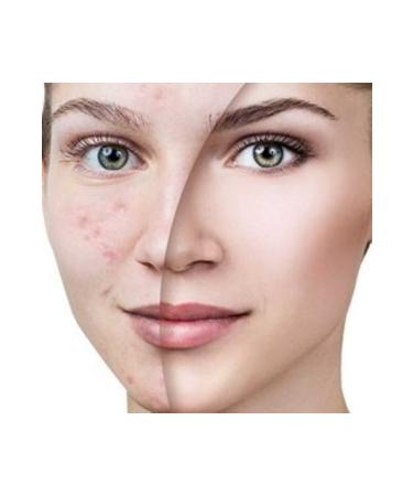 Dr.Jart + V7 Toning Light Skin Cream + Sunscreen 50ml - Buy Online on GoSupps.com