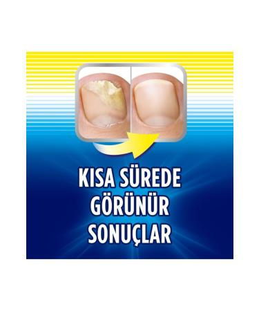 Scholl Nail Fungus Treatment Fungus Remover - Buy Online on GoSupps.com