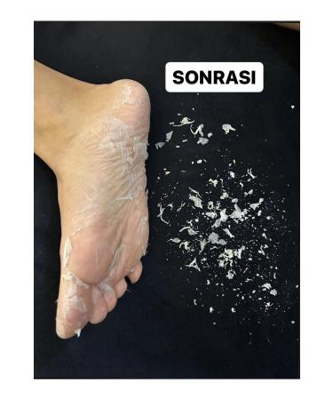 HODAF 2 Pairs Sock Type Lemon Flavored Foot Peeling Mask for Dead Skin and Cracks - Buy Online on GoSupps.com