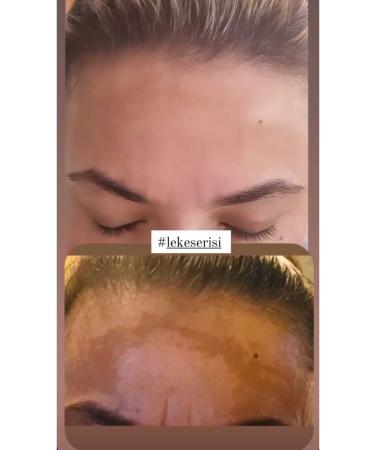 GULU NL NL Night Blemish Serum Formulated with 0 Pure Herbal Oils 40 ml - Buy Online on GoSupps.com