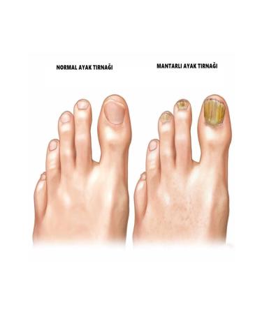 Dr Nails Nail Care and Removal Drops - Buy Online on GoSupps.com