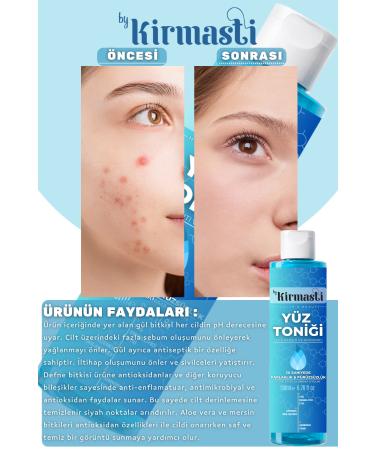 Pore Tightening Purifying and Oil Balancing Tonic for Acne Prone Skin 200ml - Buy Online on GoSupps.com