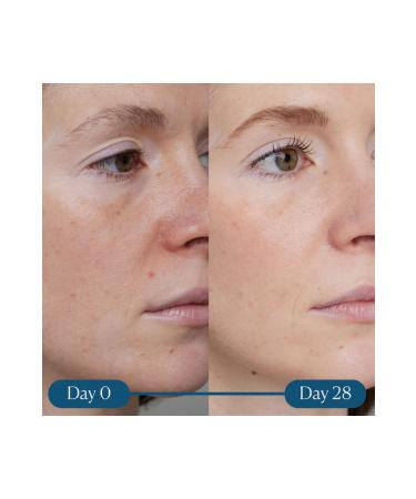 Elemis Dynamic Resurfacing Super-c Serum Vitamin C Pore Tightening Serum 30ml 641628401550 - Buy Online on GoSupps.com