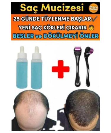 Blue Serum 2 Pieces Hair Care Nourishing Strengthening Hair Growth Lotion 1 Dermaroller Gift