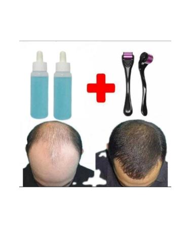 Blue Serum 2 Pieces Hair Care Nourishing Strengthening Hair Growth Lotion 1 Dermaroller Gift - Buy Online on GoSupps.com