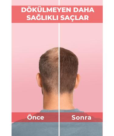 redCOS Vegan Collagen & Vegan Keratin Hair Conditioner Against Hair Breakage & Loss & Damaged Hair - Buy Online on GoSupps.com