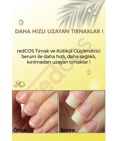 redCOS Nail and Cuticle Strengthening Active Serum - Buy Online on GoSupps.com