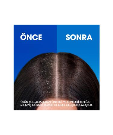 Head And Shoulders Menthol Fresh Anti-Dandruff Shampoo 750 ml - Buy Online on GoSupps.com