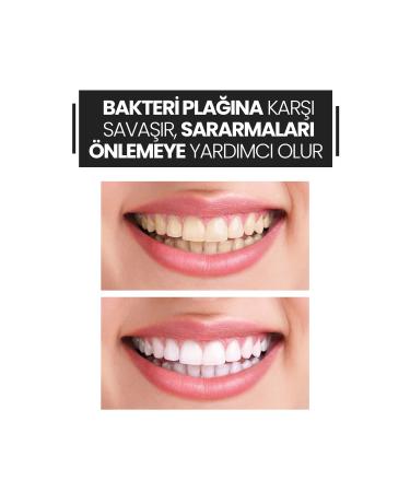 BITCHIZEN Active Carbon Teeth Whitening Powder - Buy Online on GoSupps.com
