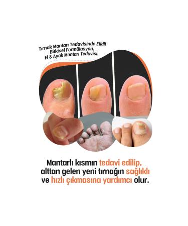 HERBIZEN Hand Foot Nail and Fungus Care Cream - Buy Online on GoSupps.com