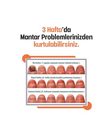 HERBIZEN Hand Foot Nail and Fungus Care Cream - Buy Online on GoSupps.com