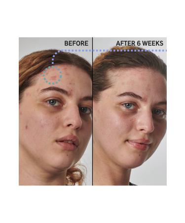 THE INKEY LIST SuperSolutions 10% Urea Moisturizer Textured Skin Solution 50 Ml - Buy Online on GoSupps.com