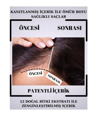 La Rachel Natural Plant Essence Shampoo That Provides Strong Protection Against Hair Loss and Promotes Hair Growth - Buy Online on GoSupps.com