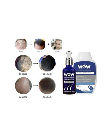Wowhaircare Hair Hair Serum 2 Pieces Dermaroller - Buy Online on GoSupps.com