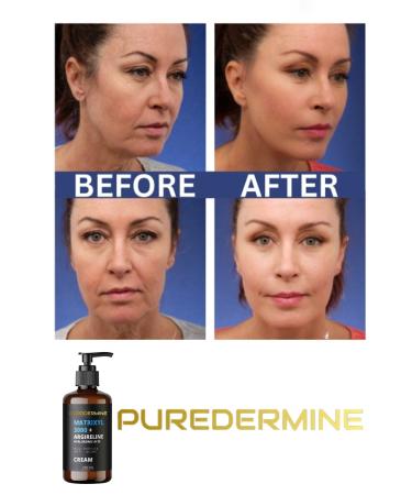 Puredermine Matrixyl 3000 Argireline Hyaluronic Acid Peptide Anti-Aging Serum Wrinkle Cream - Buy Online on GoSupps.com