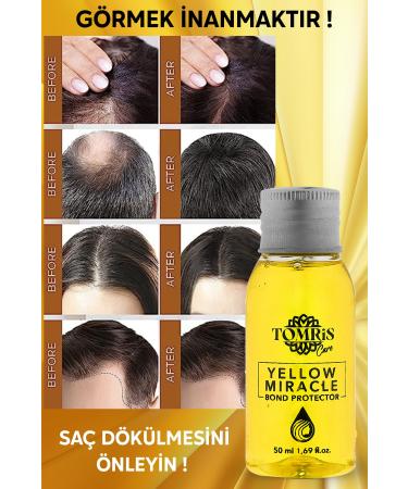 TOMRIS CARE Yellow Miracle Anti-Loss Fast Hair Growth Serum 50 Ml - Buy Online on GoSupps.com