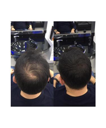 Topaxx 3 ADET Topaxx 100gr Siyah/Black Sa Fiber Topik Tozu - Buy Online on GoSupps.com