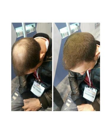 Topaxx 3 PCS Topaxx 100gr Medium Brown Hair Fiber Topical Powder - Buy Online on GoSupps.com