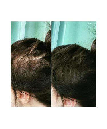 Topaxx 3 PCS Topaxx 100gr Medium Brown Hair Fiber Topical Powder - Buy Online on GoSupps.com