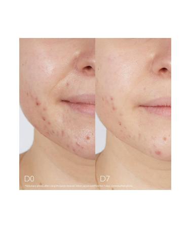 Caudalie Vinopure Anti-Acne and Anti-Blackhead Salicylic Serum for Sensitive Skin 30ml PSSNS184 - Buy Online on GoSupps.com