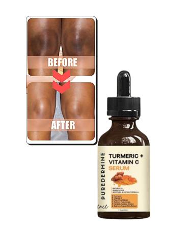 Puredermine Powerful Whitening Turmeric Serum Dark Spots & Acne & Melasma & Dark Joints & Fingers Knees & Elbows - Buy Online on GoSupps.com