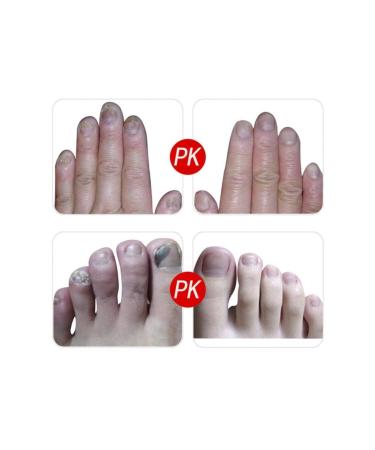 LANBENA Nail Repair Gel Nail Repair Care Gel Nail Care Gel - Buy Online on GoSupps.com