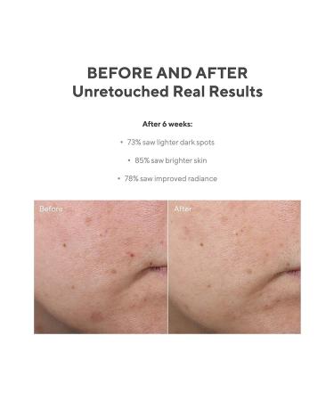 Murad Rapid Age Spot Correcting Fast Effective Skin Care Serum 30 Ml KeyProduct124 - Buy Online on GoSupps.com