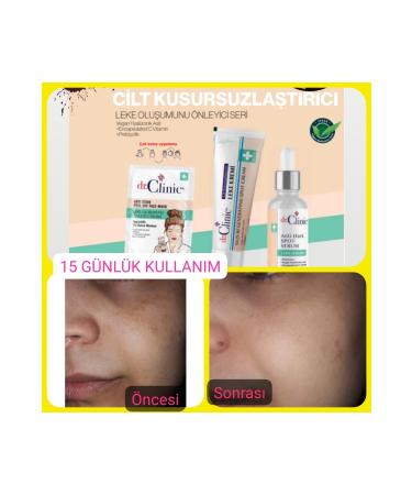 Dr. Clinic Dr.clinic Skin Perfecting Blemish Cream 50 Ml