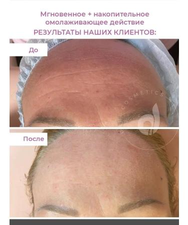 Dari cosmetics Moisturizing whey of face from wrinkles - Buy Online on GoSupps.com