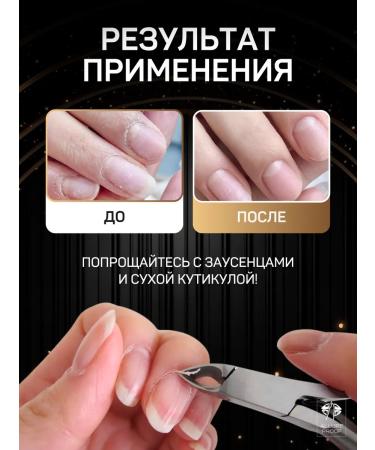 Allure Proof Kusachki for cutter manicure - Buy Online on GoSupps.com