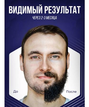 Xinoxin Xynsin 5% for hair growth and beard 6pcs - Buy Online on GoSupps.com
