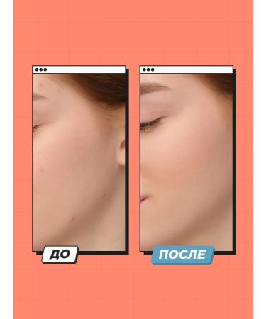 SENTENSLAB Enzyme gel for washing with papain - Buy Online on GoSupps.com