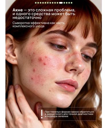 Semily Facial serum against acne with niacinamide - Buy Online on GoSupps.com