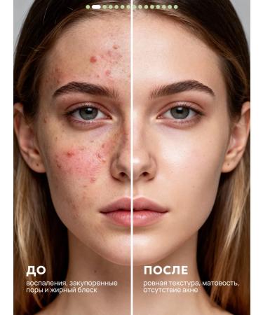 Semily Facial serum against acne with niacinamide - Buy Online on GoSupps.com